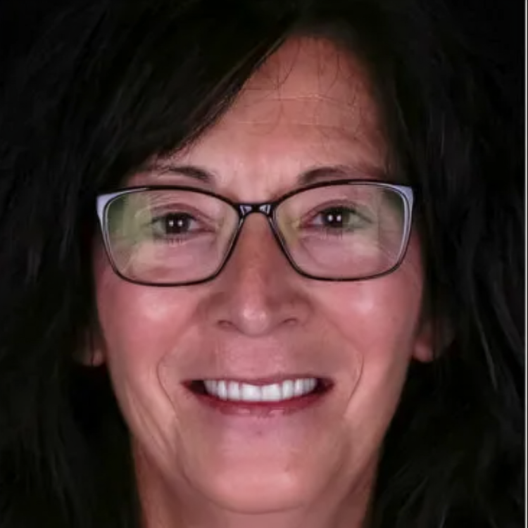 Smiling woman after the dental implants